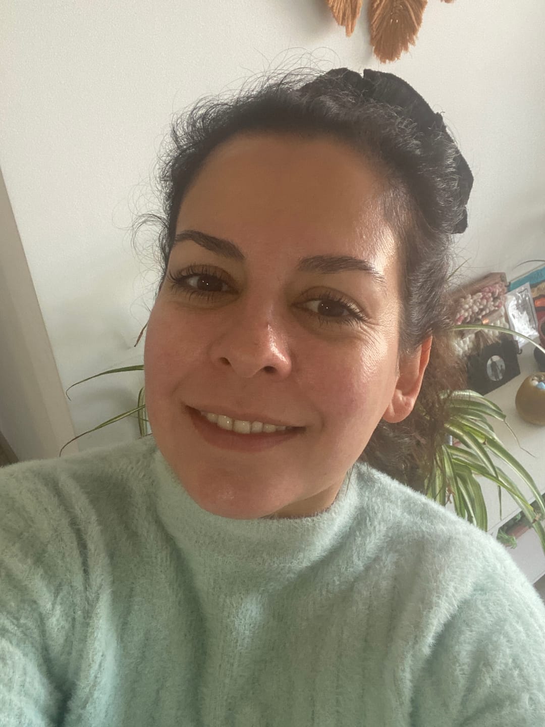 Customer photo review of Emulsión Recuperadora Delicate Touch.  Alivio real para pieles con dermatitis, rosácea y sensibilidad extrema.