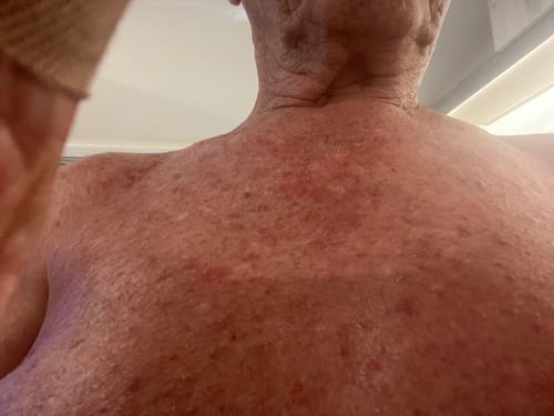 Customer photo review of Miracle Balm