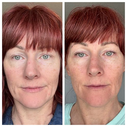 Customer photo review of The Complete System for Mature Women’s Skin