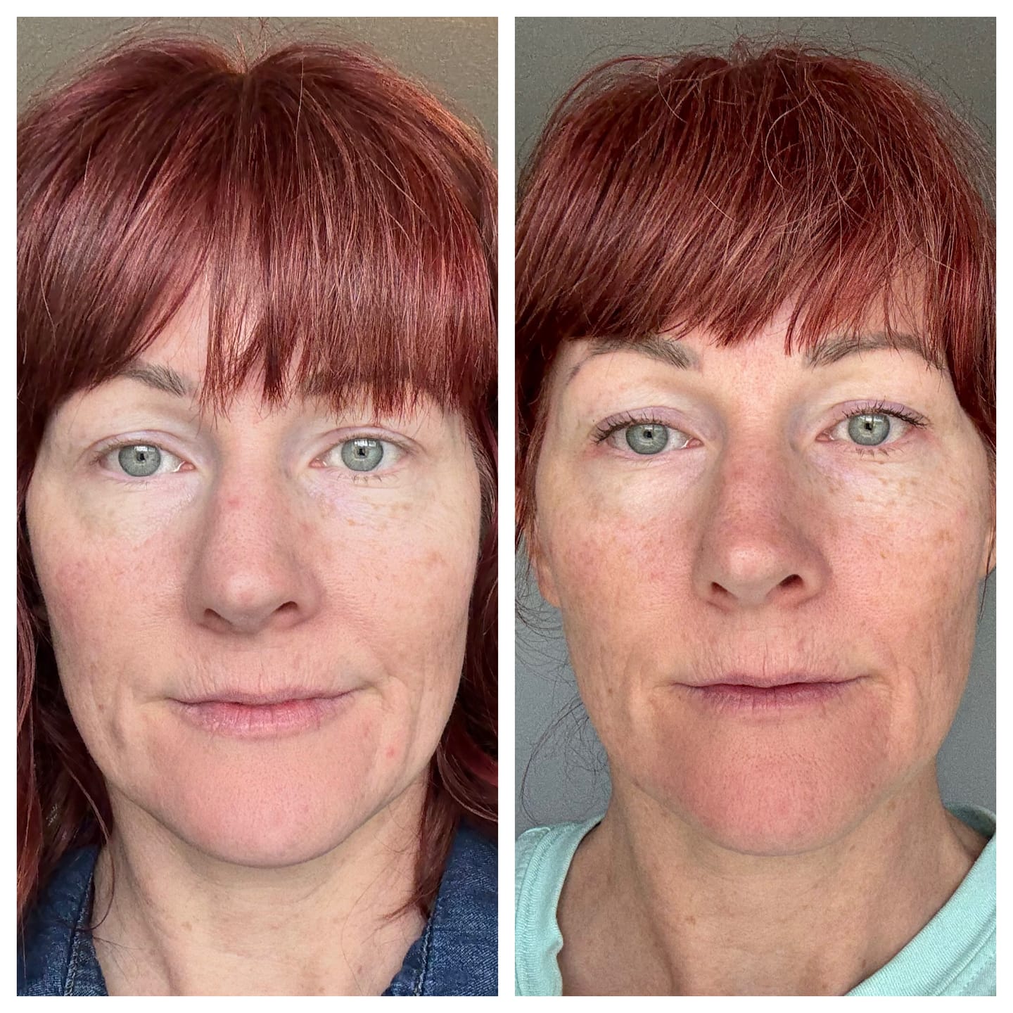 Customer photo review of The Complete System for Mature Women’s Skin