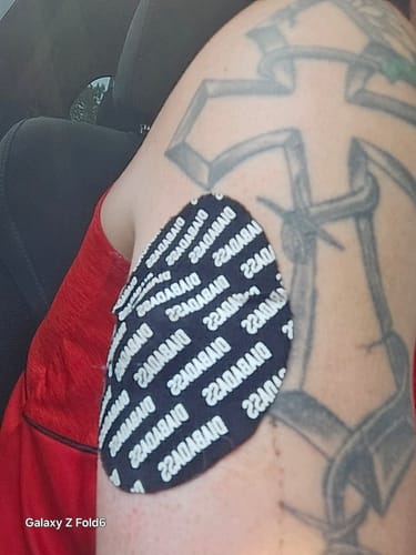 Customer photo review of Skin Grip Original - Medtronic Guardian/Enlite Adhesive Patches