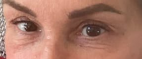 Customer photo review of LASHCOCA!NE - Wimpernserum