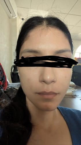 Customer photo review of Seyoul™ Suero 21 Días - H01