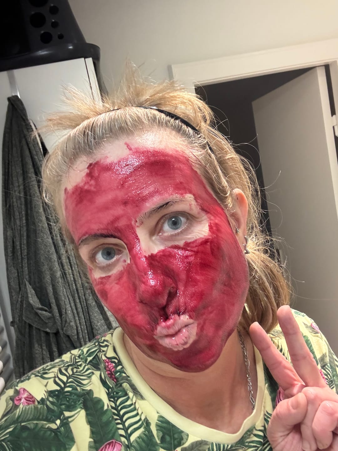 Customer photo review of VAMPIRE PEEL® - Fruchtsäurepeeling