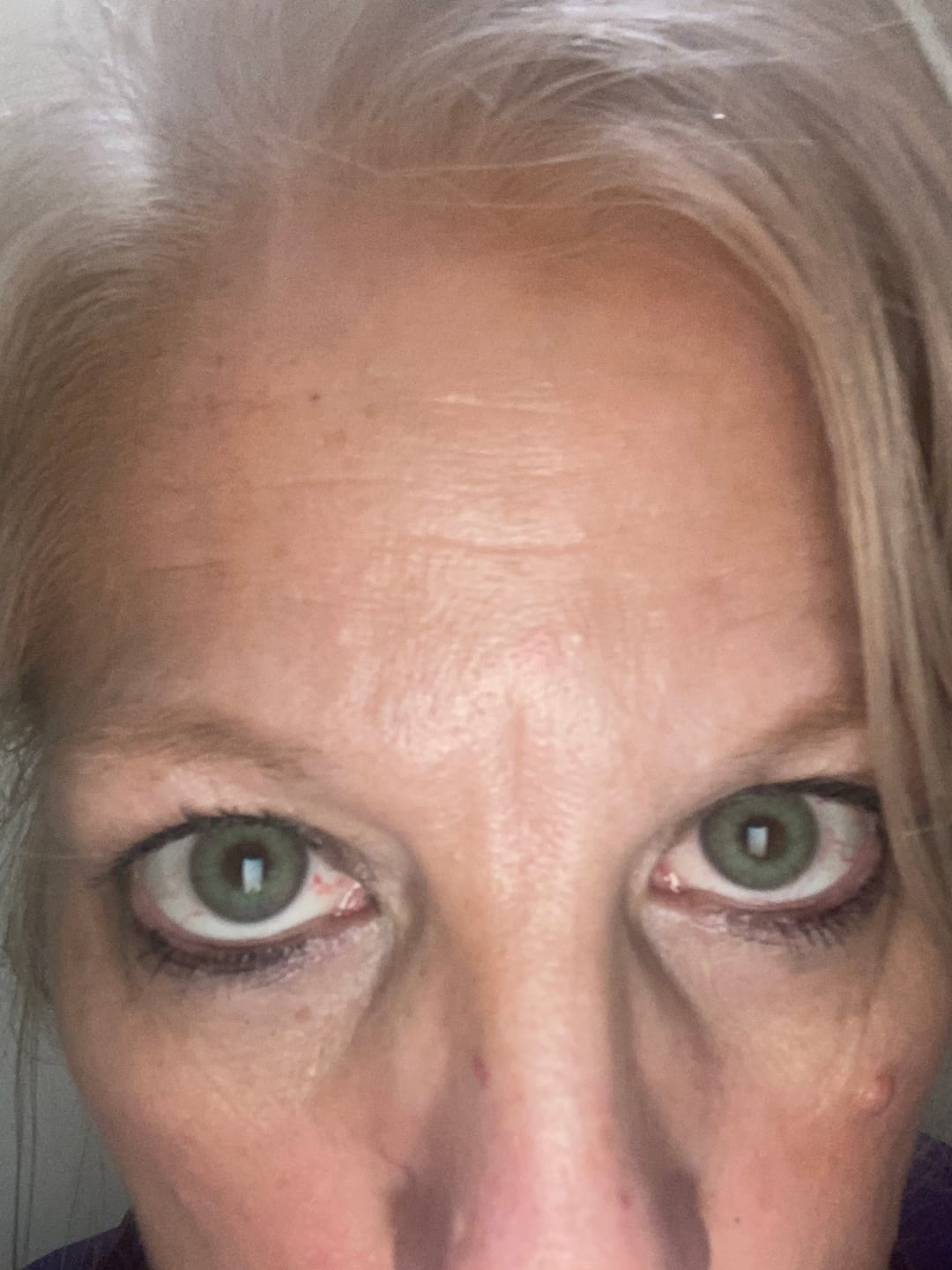 Customer photo review of Halo Dark Green Prescription Colored Contact Lenses