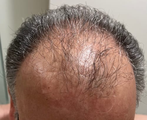 Customer photo review of FULLR+