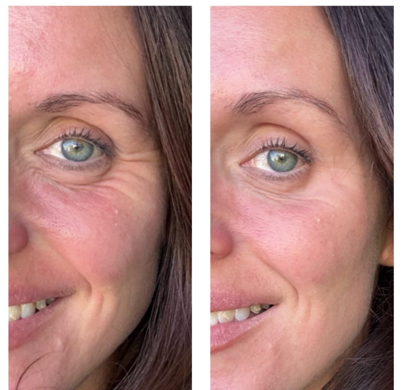 Customer photo review of Sea Cucumber Collagen Instant Lift Eye Serum