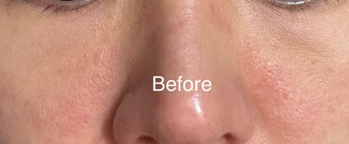 undefined review of mesoestetic x.prof 040 centella asiatica ampoules (2mL x 20) image 1 out of 2