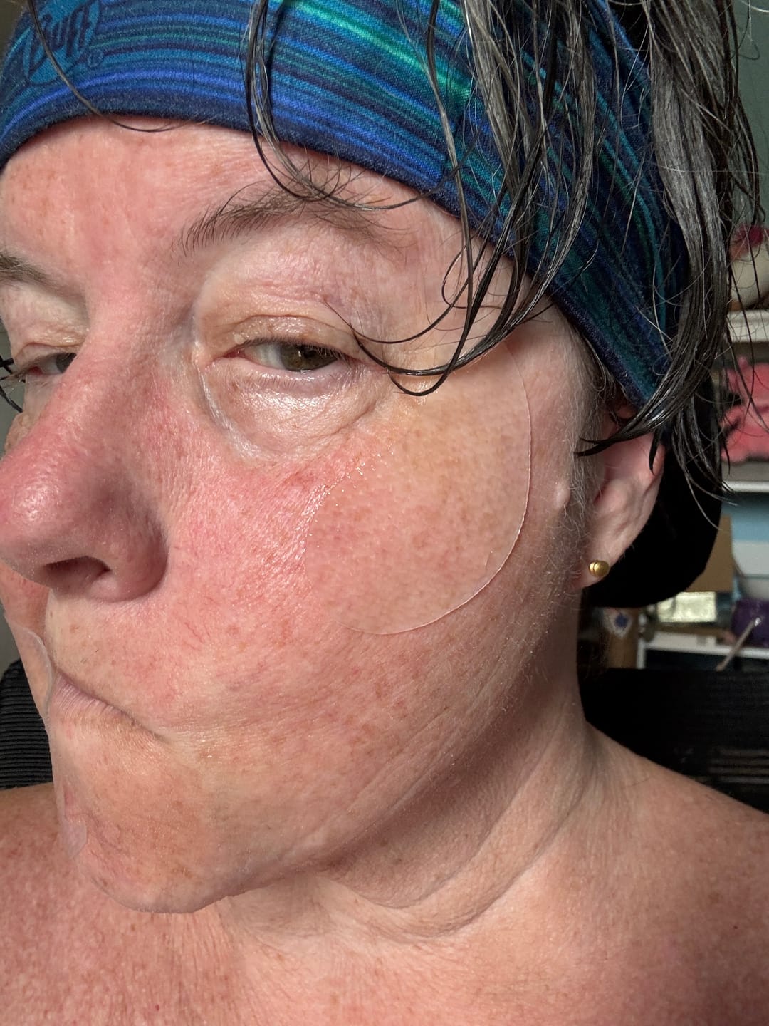Customer photo review of Collagen eye patch Jericho rose jelly