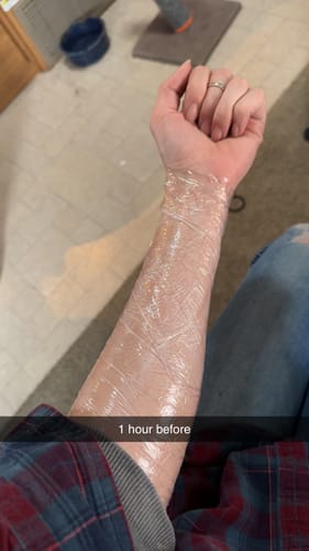 Customer photo review of Painless Tattoo Numbing Cream