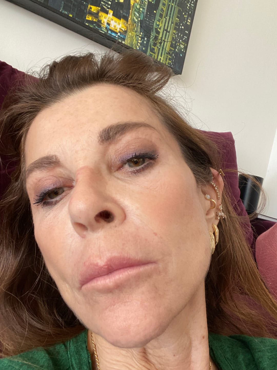 Customer photo review of Anti-Aging treatment