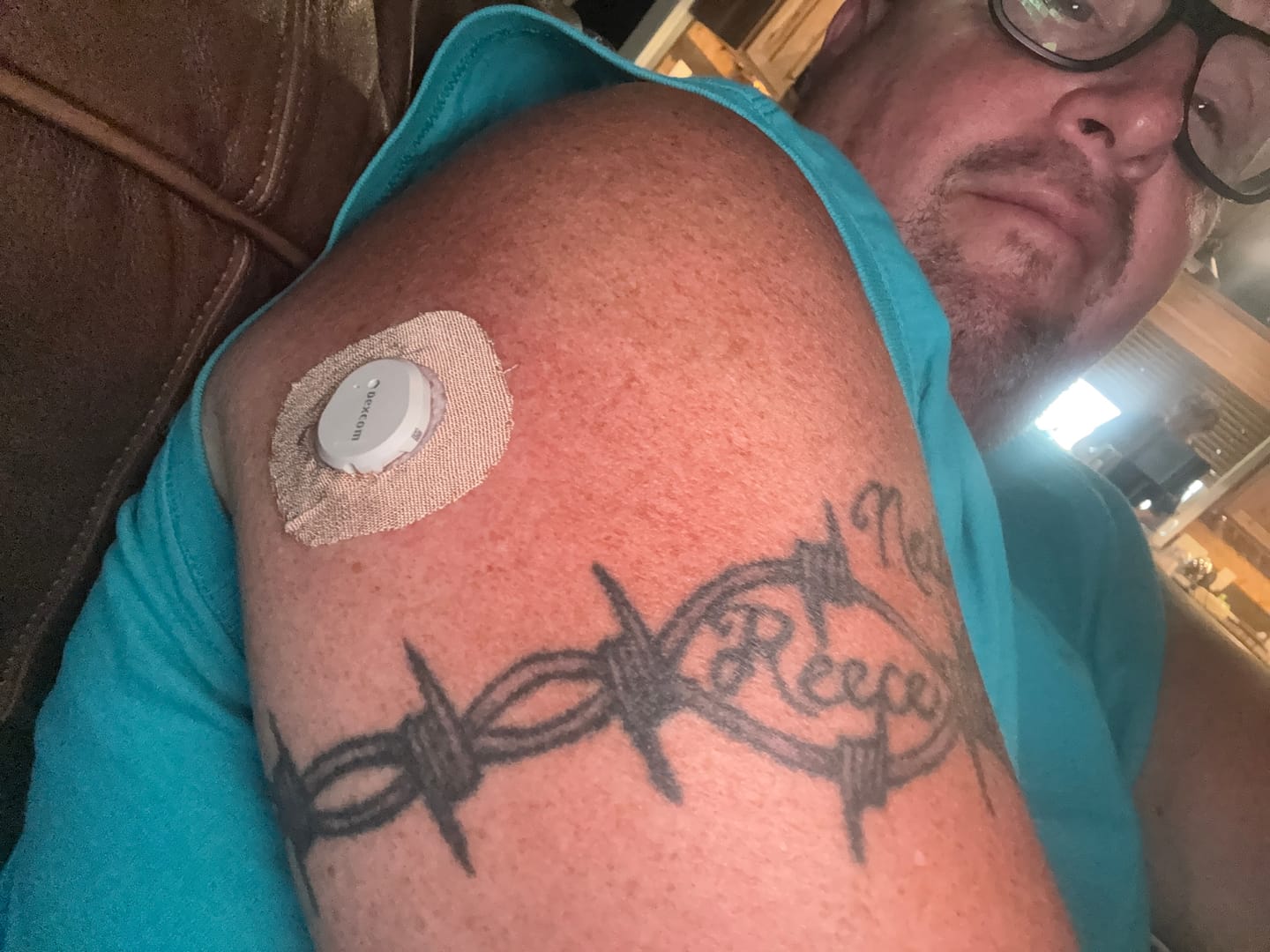 Customer photo review of Skin Grip Original - Dexcom G7 & Stelo Adhesive Patches (With Cutout)