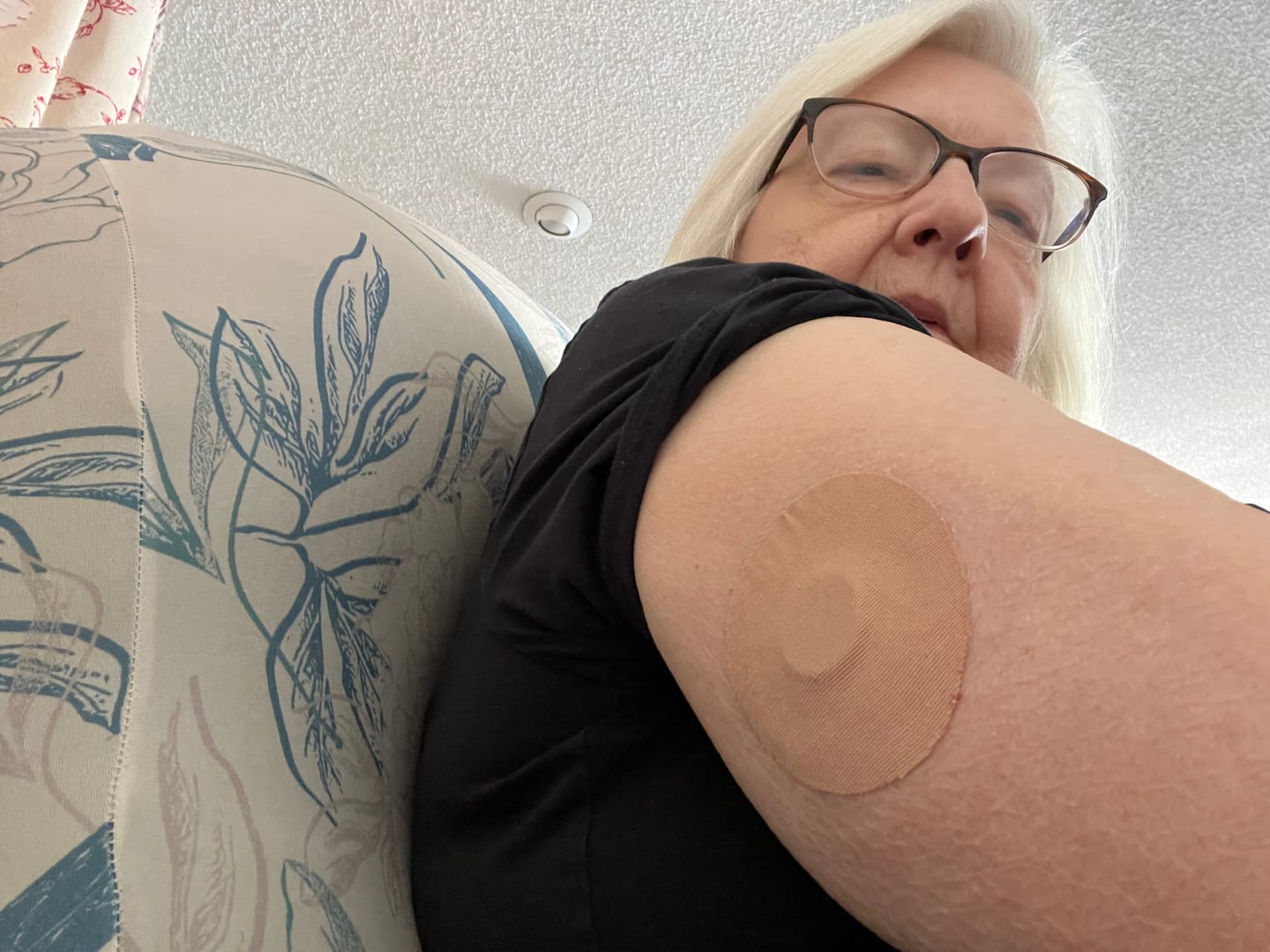 Customer photo review of Skin Grip Original - Dexcom G7 & Stelo Adhesive Patches