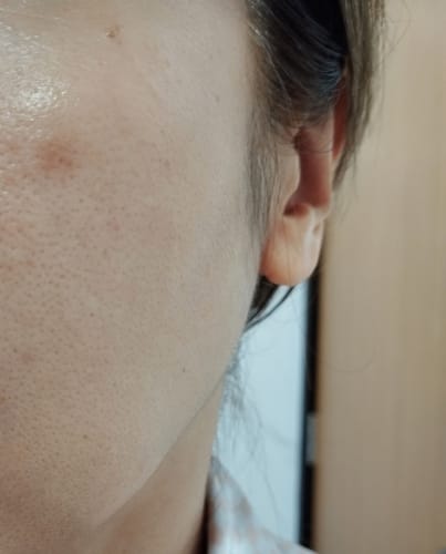 Customer photo review of OUTGLOW - Radiance Tri-Factor™ Jelly