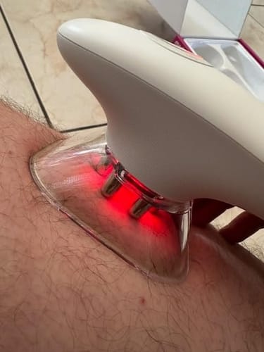 Customer photo review of AuraSculpt | 3 in 1 Face & Body Sculpting Device