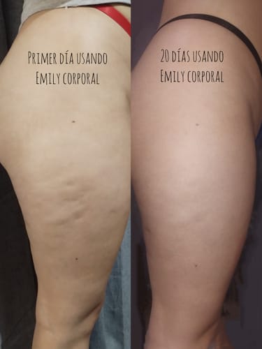 Customer photo review of Crema AntiCelulitis🧴🦵 - 200ml EMILY