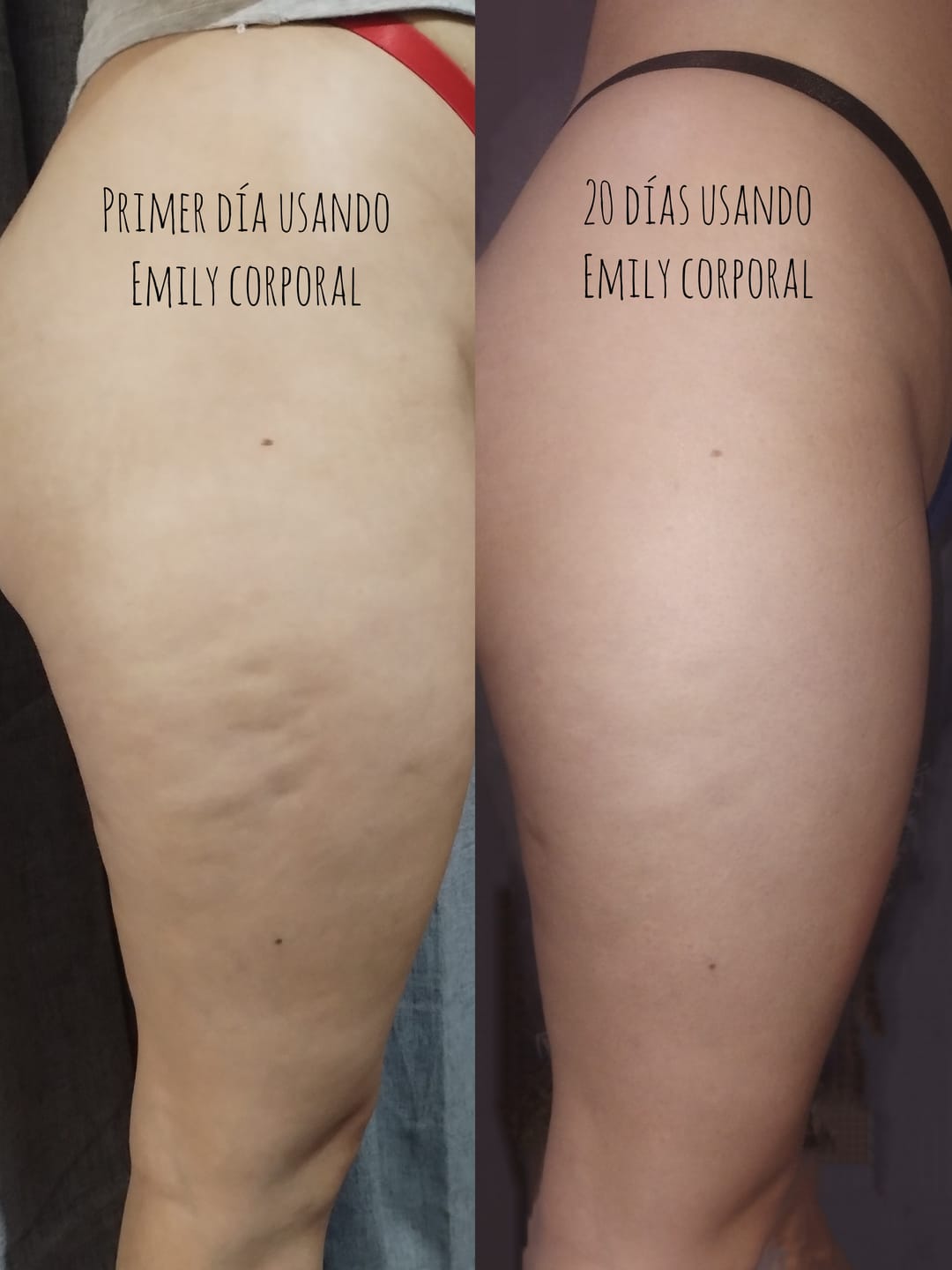 Customer photo review of Crema AntiCelulitis🧴🦵 - 200ml EMILY