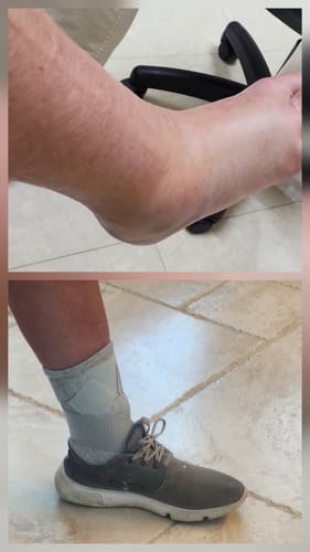 Customer photo review of Premium Bamboo Ankle Support
