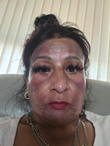 Customer photo review of Pink Blossom - Intimate Area Brightening Treatment