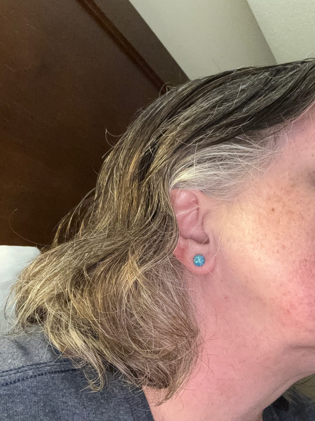 Customer photo review of Gold Fleck Button 8mm Studs Hypoallergenic Earrings for Sensitive Ears Made with Plastic Posts