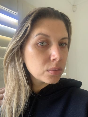 Customer photo review of The Glo Cleansing Exfoliating Balm