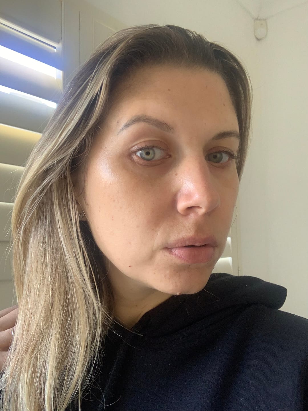 Customer photo review of The Glo Cleansing Exfoliating Balm