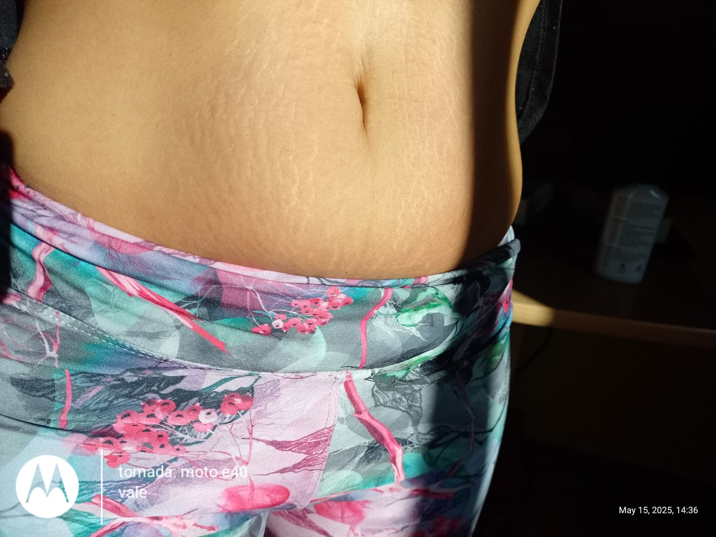 Customer photo review of Crema AntiEstrías🧴🦵 - 200ml EMILY