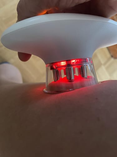 Customer photo review of AuraSculpt | 3 in 1 Face & Body Sculpting Device