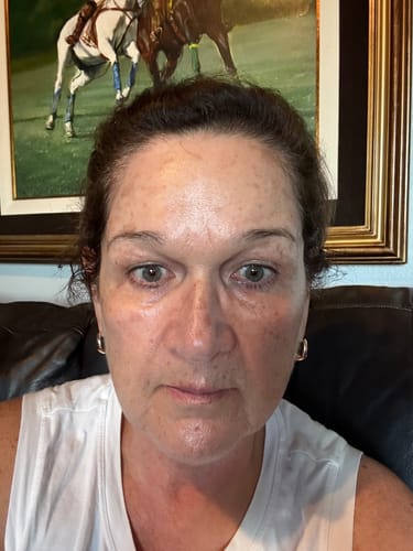 Customer photo review of DIVINE9 Facial Serum