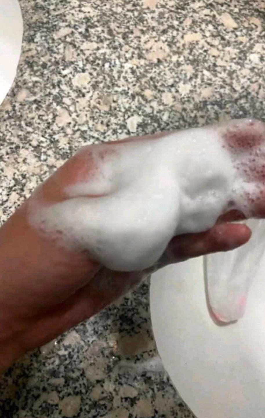 Customer photo review of Polyamino Acid Purifying Facial Cleanser