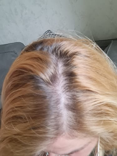 Customer photo review of Sunkissed Starter Kit