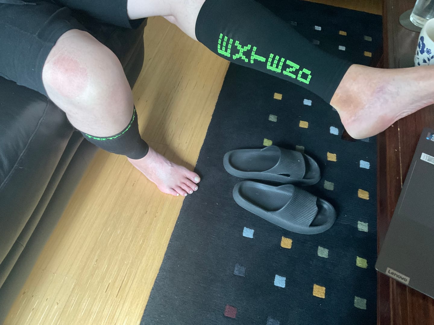Customer photo review of eXtend High – Kompressio- ja hoitosäärystimet – Paineluokka 2 – Musta/lime