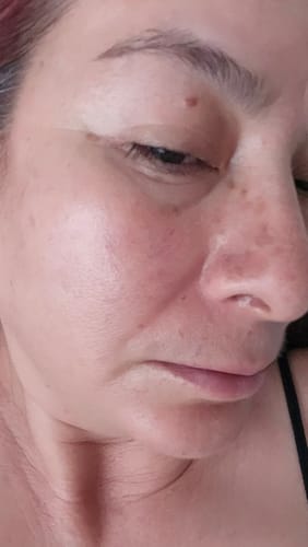 Customer photo review of Combo Renueva Tu Piel - Oferta HOTSALE