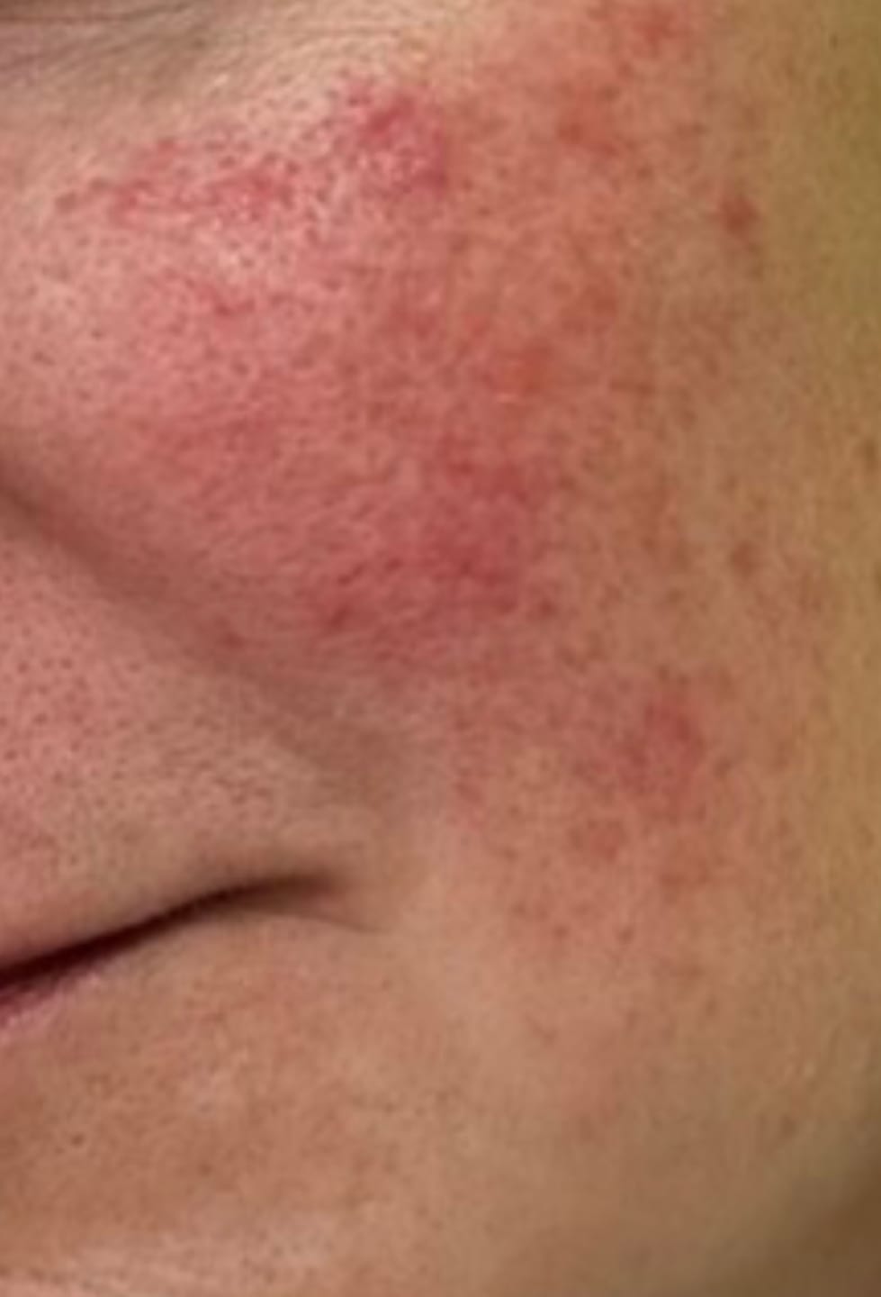 Customer photo review of Maigs hidrofīlais balzams ādas attīrīšanai Dr. Althea Pure Grinding Cleansing Balm