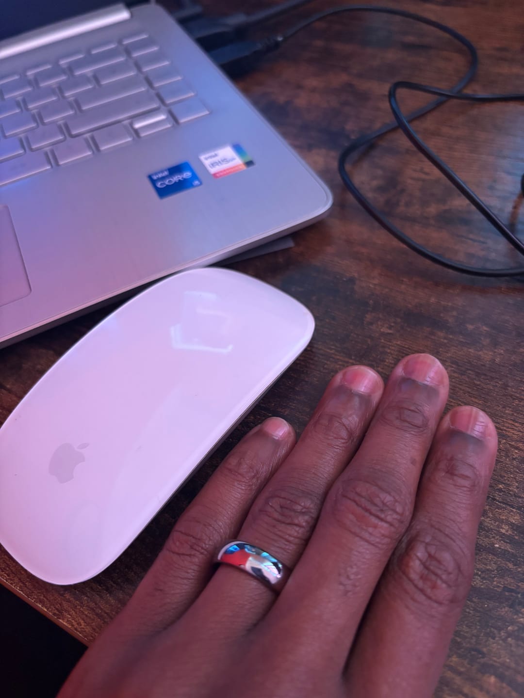 Customer photo review of Original 6mm Wonder Ring