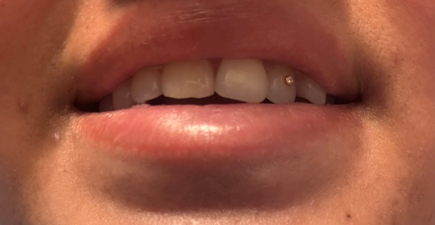 Customer photo review of Round w. Diamond 0.01 ct 22-karat gold