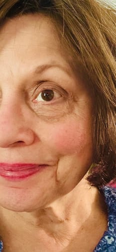 Customer photo review of Neptune Grass Fed Tallow & Honey Balm