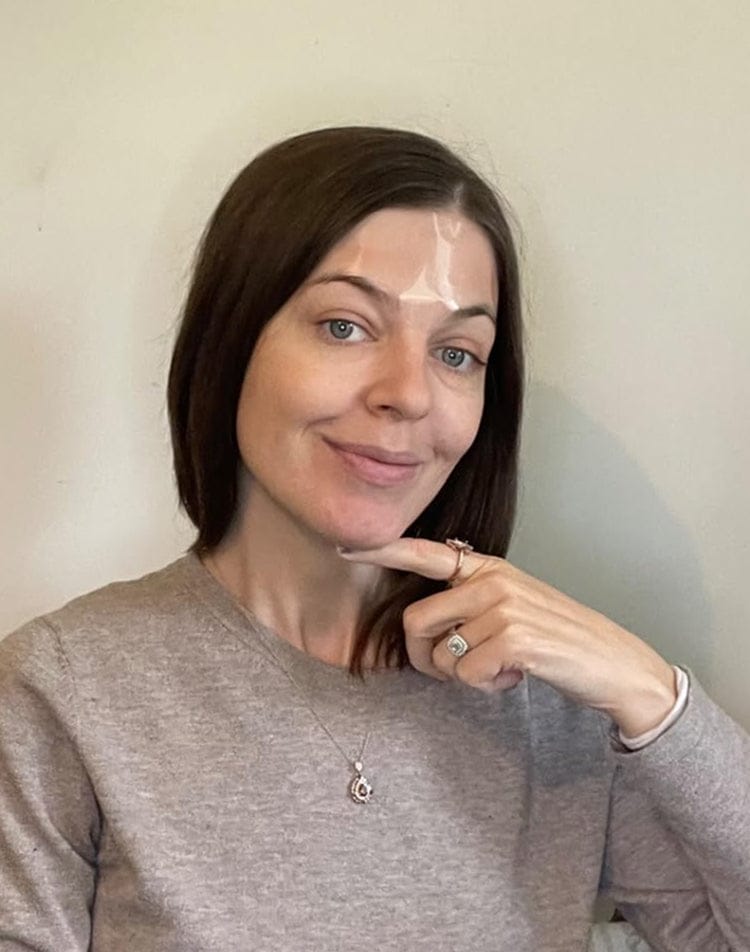 Customer photo review of Superlift пластири за бръчки