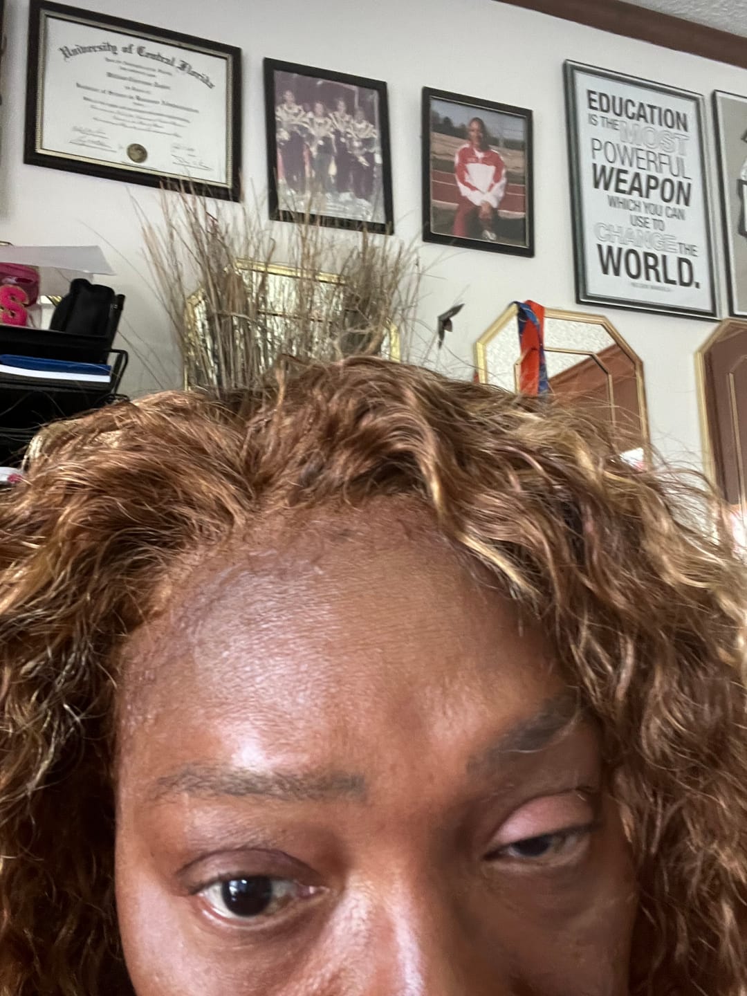 Customer photo review of Lace Glue Remover
