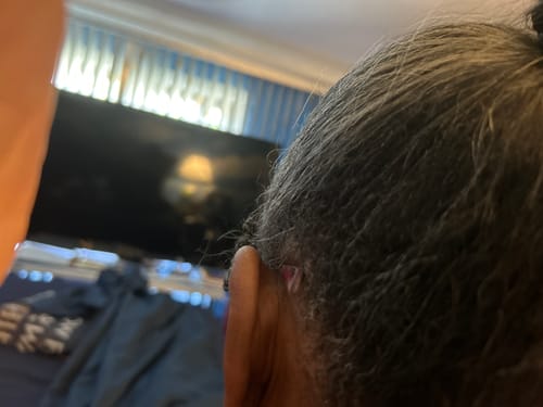 Customer photo review of Allurium Hair Growth Serum Auto renew