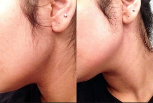 Customer photo review of Painless Hair Removal Cream