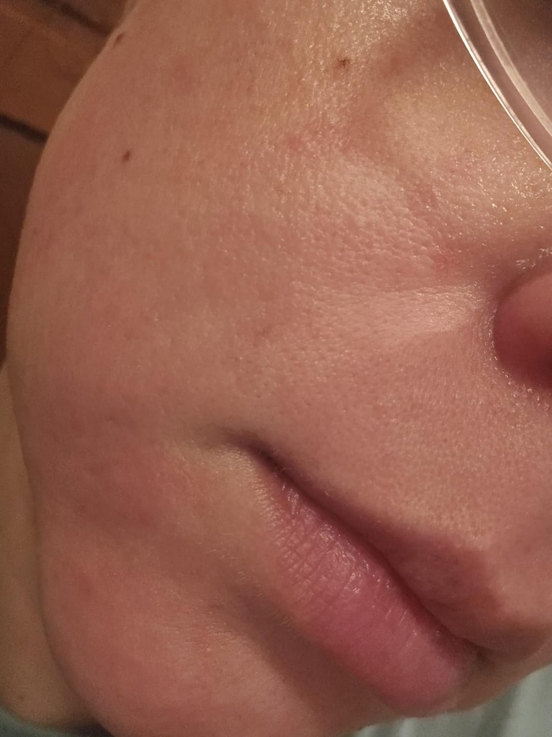 Customer photo review of Painless Hair Removal Cream