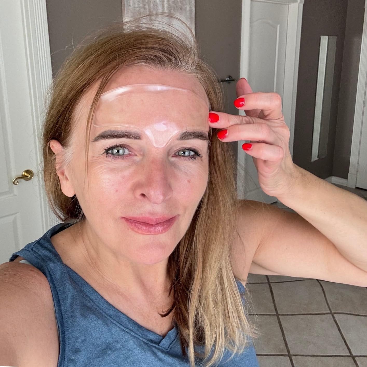 Customer photo review of Superlift пластири за бръчки