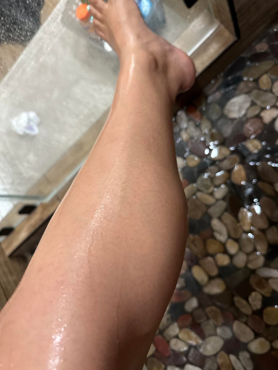 Customer photo review of Painless Hair Removal Cream