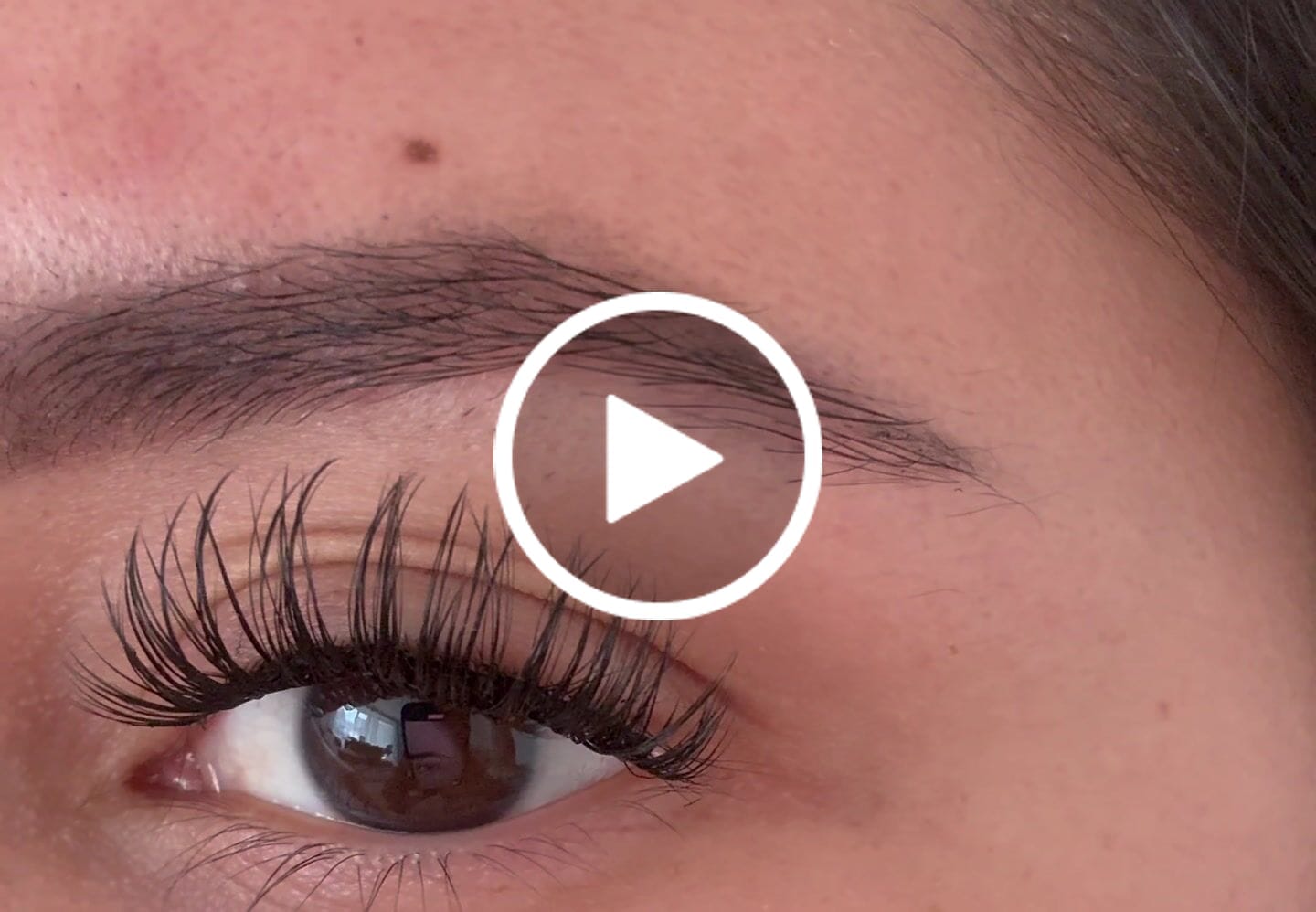 Customer video review of élite THE TWEEZER