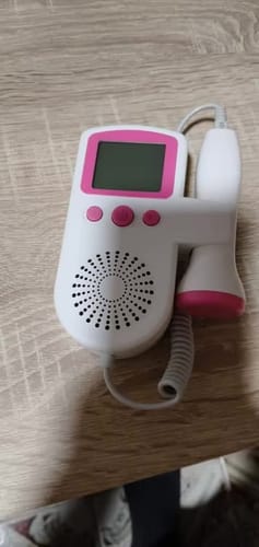 Customer photo review of BabyBeat