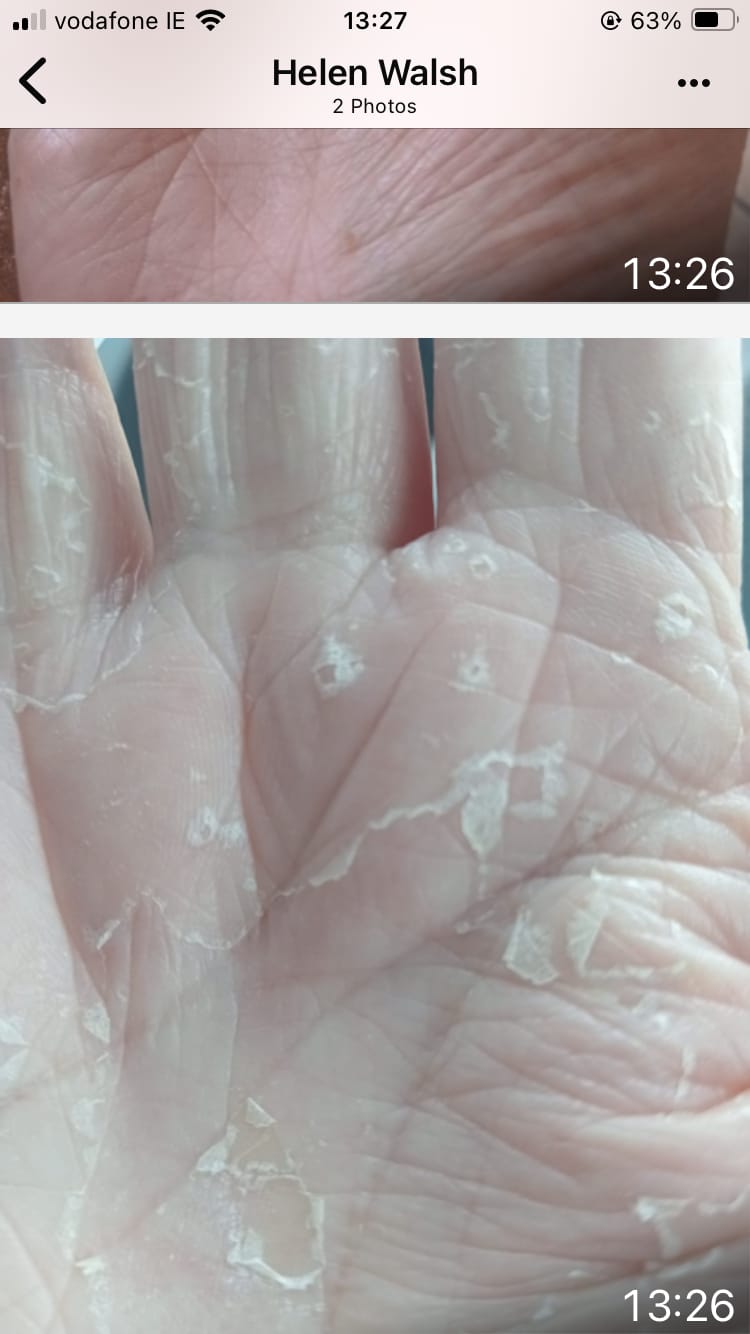 Customer photo review of Bioskin Duo Pack