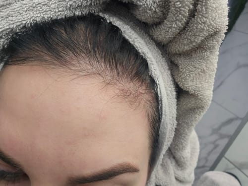 Customer photo review of Glow + Grow Hair Growth Collagen