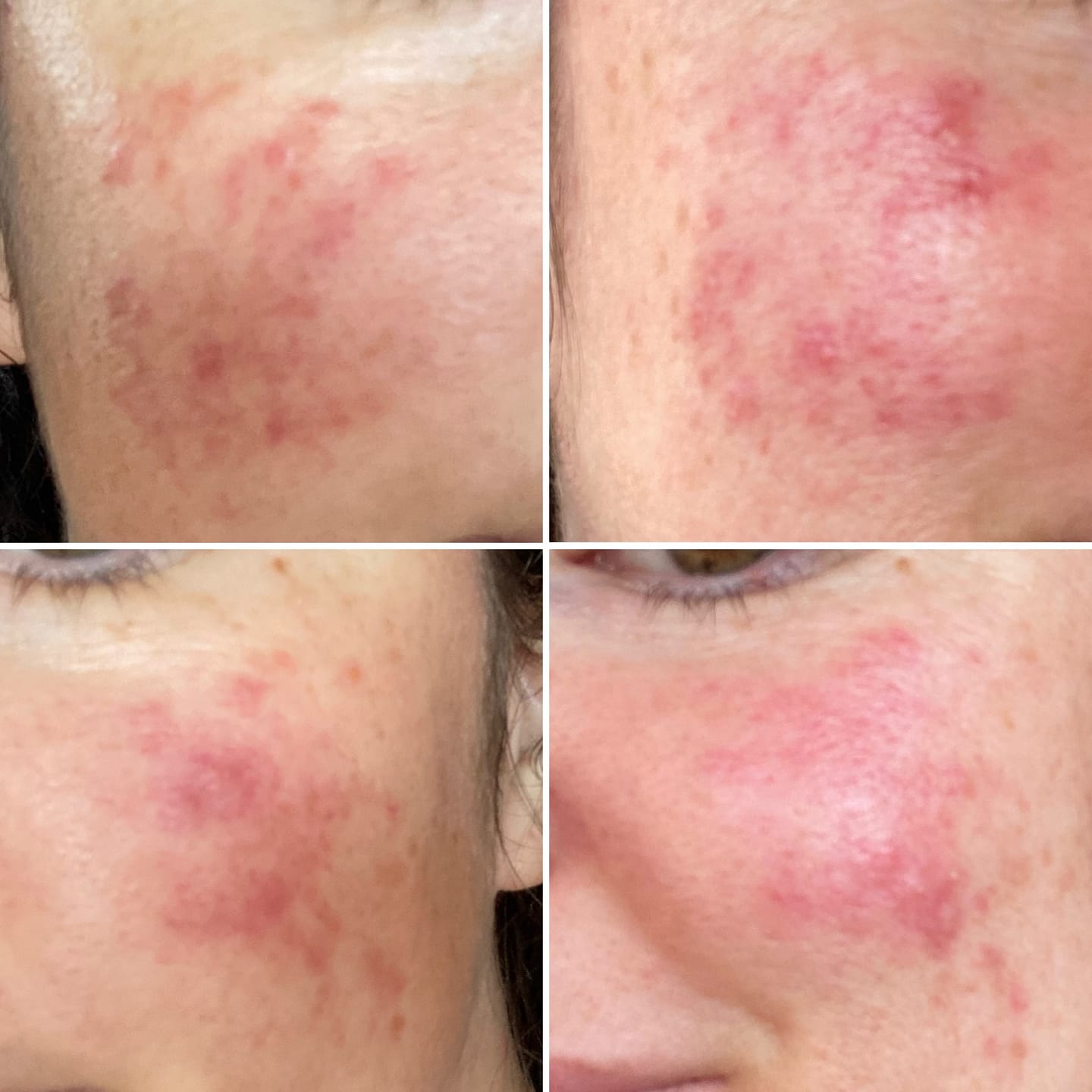 Customer photo review of Reisestørrelse FitYourSkinxKaRebeauty YUJA Cleansing Balm (8ml) - Oljerens