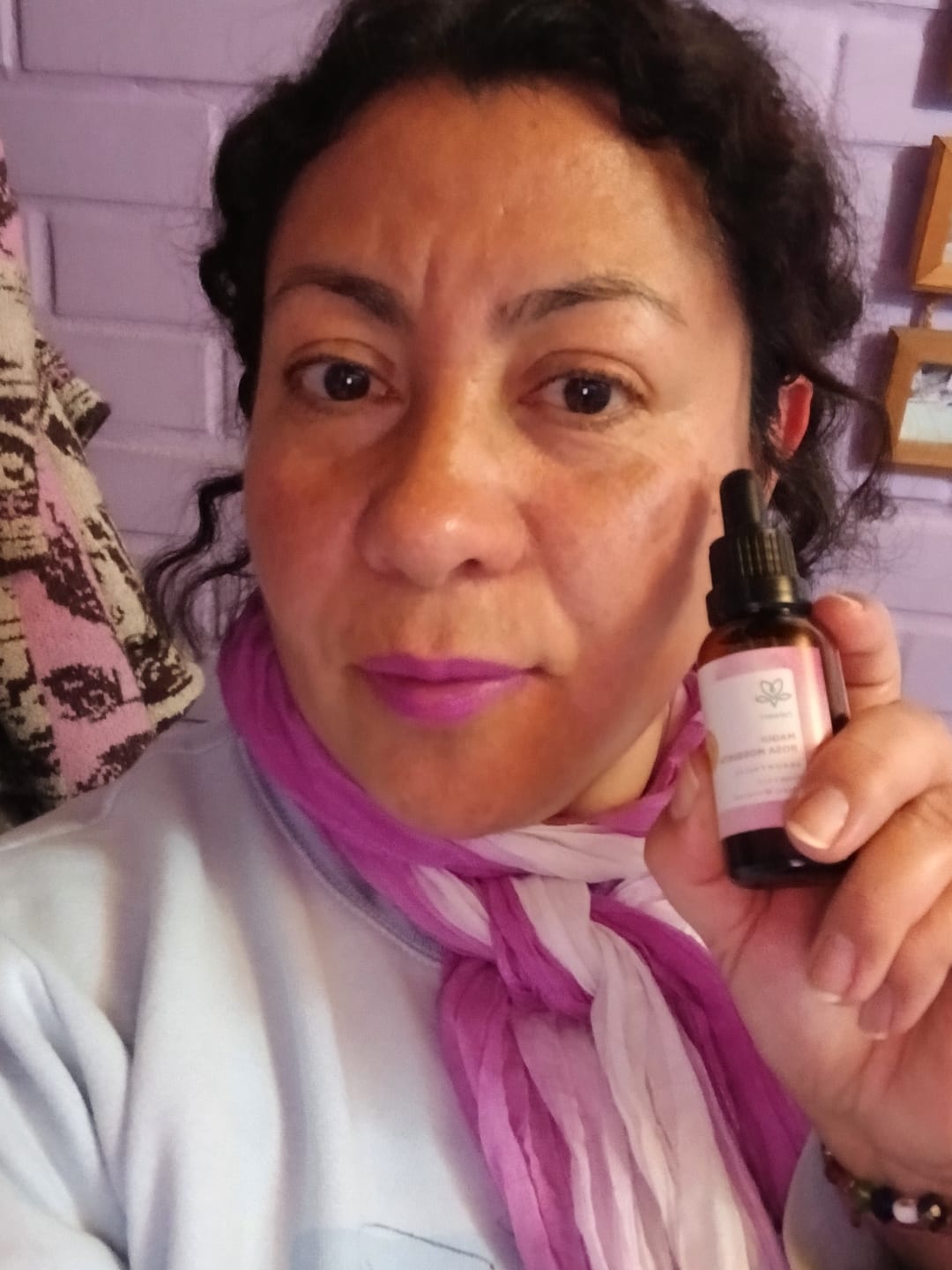 Customer photo review of Pack Tratamiento Concentrado Antiedad